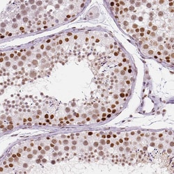 Invitrogen HDAC1 Monoclonal Antibody (CL0510) 100 &mu;L; Unconjugated:Antibodies,