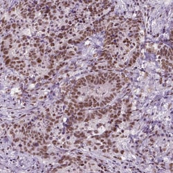 Invitrogen BRD4 Monoclonal Antibody (CL1115) 100 &mu;L; Unconjugated:Antibodies,