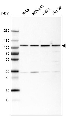 Invitrogen GRP94 Monoclonal Antibody (CL2647) 100 &mu;L | Buy Online | Invitrogen&trade; | Fisher Scientific
