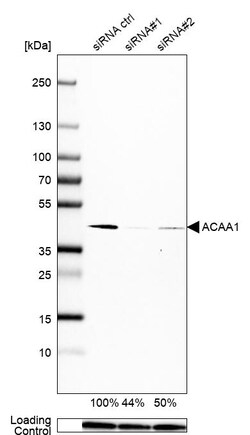 Invitrogen ACAA1 Monoclonal Antibody (CL2663) 100 &mu;L | Buy Online | Invitrogen&trade; | Fisher Scientific