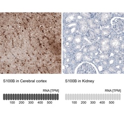 Invitrogen S100B Monoclonal Antibody (CL2720) 100 &mu;L; Unconjugated:Antibodies,