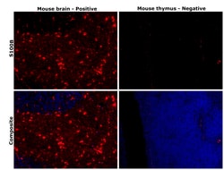 Invitrogen S100B Monoclonal Antibody (CL2720) 100 &mu;L; Unconjugated:Antibodies,