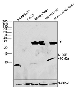 Invitrogen S100B Monoclonal Antibody (CL2720) 100 &mu;L; Unconjugated:Antibodies,