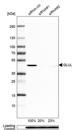 Invitrogen Glutamine Synthetase Monoclonal Antibody (CL2999) 100 &mu;L;