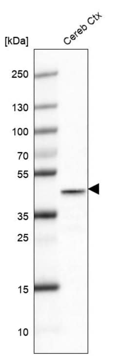 Invitrogen Glutamine Synthetase Monoclonal Antibody (CL2999) 100 &mu;L;