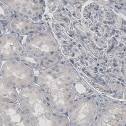 Invitrogen Glutamine Synthetase Monoclonal Antibody (CL3004) 100 &mu;L;