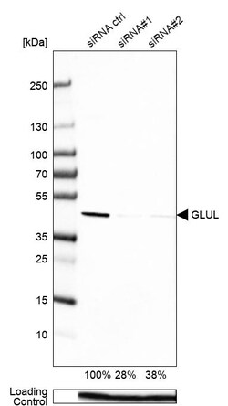 Invitrogen Glutamine Synthetase Monoclonal Antibody (CL3004) 100 &mu;L;