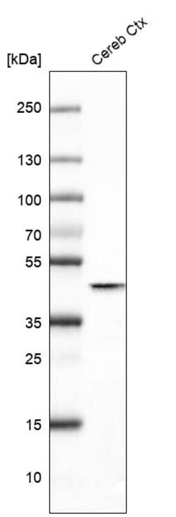Invitrogen Glutamine Synthetase Monoclonal Antibody (CL3004) 100 &mu;L;
