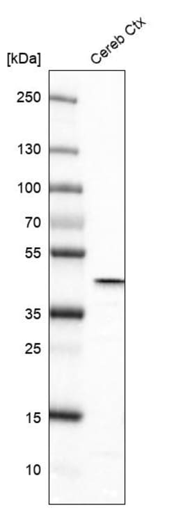 Invitrogen Glutamine Synthetase Monoclonal Antibody (CL3004) 100 &mu;L;