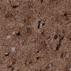 Invitrogen Glutamine Synthetase Monoclonal Antibody (CL3013) 100 &mu;L;