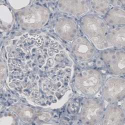 Invitrogen Glutamine Synthetase Monoclonal Antibody (CL3013) 100 &mu;L;