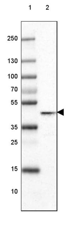 Invitrogen Glutamine Synthetase Monoclonal Antibody (CL3013) 100 &mu;L;