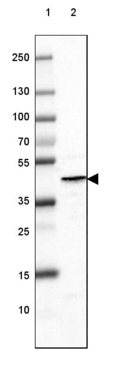 Invitrogen Glutamine Synthetase Monoclonal Antibody (CL3013) 100 &mu;L;