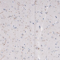 Invitrogen TPH2 Monoclonal Antibody (CL2990) 100 &mu;L | Buy Online | Invitrogen&trade; | Fisher Scientific