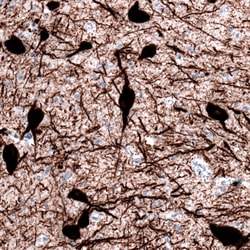 Invitrogen TPH2 Monoclonal Antibody (CL2990) 100 &mu;L | Buy Online | Invitrogen&trade; | Fisher Scientific
