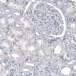Invitrogen TPH2 Monoclonal Antibody (CL2990) 100 &mu;L | Buy Online | Invitrogen&trade; | Fisher Scientific