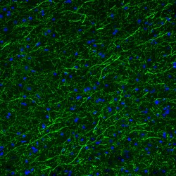 Invitrogen TPH2 Monoclonal Antibody (CL2990) 100 &mu;L | Buy Online | Invitrogen&trade; | Fisher Scientific