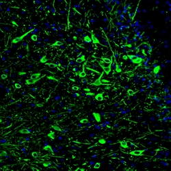 Invitrogen&trade;&nbsp;TPH2 Monoclonal Antibody (CL2990)