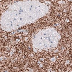 Invitrogen Dopamine Transporter Monoclonal Antibody (CL3123) 100 &mu;L;