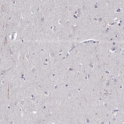 Invitrogen Dopamine Transporter Monoclonal Antibody (CL3123) 100 &mu;L;