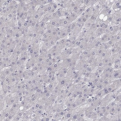 Invitrogen Dopamine Transporter Monoclonal Antibody (CL3123) 100 &mu;L;