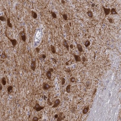 Invitrogen™ Dopamine Transporter Monoclonal Antibody (CL3123)