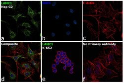 Invitrogen Laminin gamma-1 Monoclonal Antibody (CL3196) 100 &mu;L; Unconjugated:Antibodies,