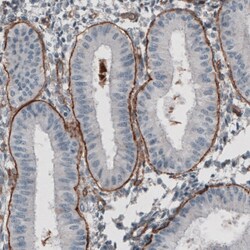 Invitrogen Laminin gamma-1 Monoclonal Antibody (CL3196) 100 &mu;L; Unconjugated:Antibodies,