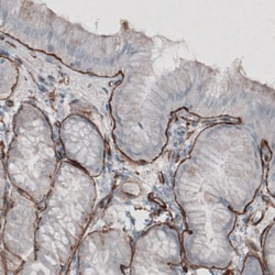 Invitrogen Laminin gamma-1 Monoclonal Antibody (CL3196) 100 &mu;L; Unconjugated:Antibodies,