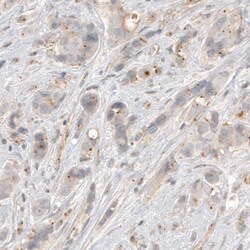 Invitrogen CDK5RAP2 Monoclonal Antibody (CL3392) 100 &mu;L; Unconjugated:Antibodies,