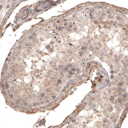 Invitrogen CDK5RAP2 Monoclonal Antibody (CL3392) 100 &mu;L; Unconjugated:Antibodies,