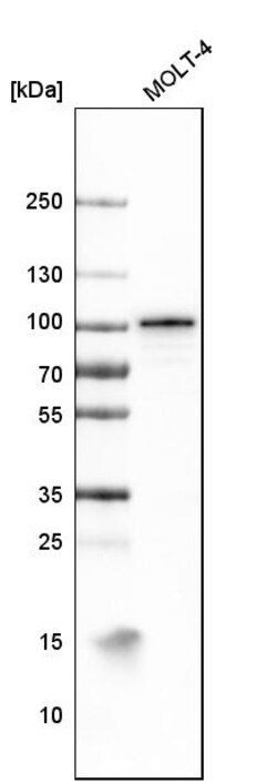 Invitrogen B-Raf Monoclonal Antibody (CL4003) 100 &mu;L | Buy Online | Invitrogen&trade; | Fisher Scientific