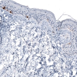 Invitrogen TYRP1 Monoclonal Antibody (CL4906) 100 &mu;L; Unconjugated:Antibodies,