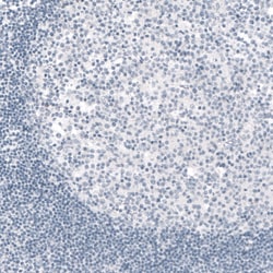 Invitrogen TYRP1 Monoclonal Antibody (CL4906) 100 &mu;L; Unconjugated:Antibodies,