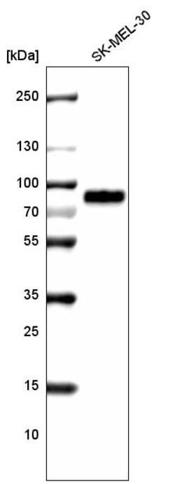 Invitrogen TYRP1 Monoclonal Antibody (CL4923) 100 &mu;L; Unconjugated:Antibodies,