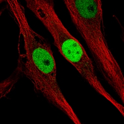Invitrogen KLF4 Monoclonal Antibody (CL5782) 100 &mu;L; Unconjugated:Antibodies,