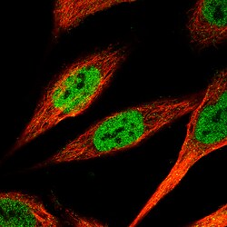 Invitrogen KLF4 Monoclonal Antibody (CL5782) 100 &mu;L; Unconjugated:Antibodies,