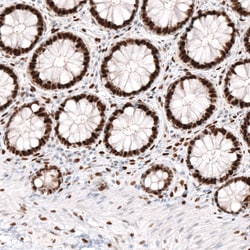 Invitrogen KLF4 Monoclonal Antibody (CL5782) 100 &mu;L; Unconjugated:Antibodies,