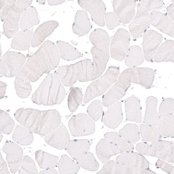 Invitrogen KLF4 Monoclonal Antibody (CL5782) 100 &mu;L; Unconjugated:Antibodies,