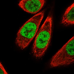 Invitrogen KLF4 Monoclonal Antibody (CL5785) 100 &mu;L; Unconjugated:Antibodies,