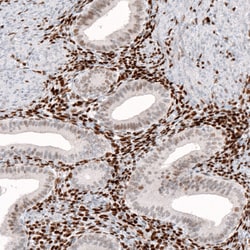 Invitrogen KLF4 Monoclonal Antibody (CL5785) 100 &mu;L; Unconjugated:Antibodies,