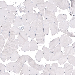 Invitrogen KLF4 Monoclonal Antibody (CL5785) 100 &mu;L; Unconjugated:Antibodies,