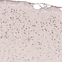 Invitrogen POU3F2 Monoclonal Antibody (CL6228) 100 &mu;L | Buy Online | Invitrogen&trade; | Fisher Scientific