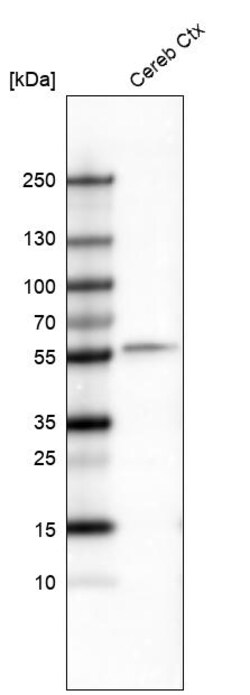 Invitrogen POU3F2 Monoclonal Antibody (CL6228) 100 &mu;L | Buy Online | Invitrogen&trade; | Fisher Scientific