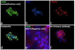 Invitrogen CDK6 Recombinant Rabbit Monoclonal Antibody (0O6X7) 100 &mu;L;