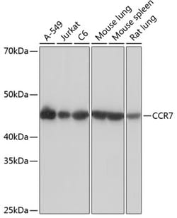 Invitrogen CCR7 Recombinant Rabbit Monoclonal Antibody (5U7S5) 100 &mu;L | Buy Online | Invitrogen&trade; | Fisher Scientific