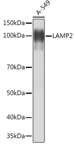 Invitrogen LAMP2 Recombinant Rabbit Monoclonal Antibody (5N8J3) 100 &mu;L;