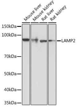 Invitrogen LAMP2 Recombinant Rabbit Monoclonal Antibody (5N8J3) 100 &mu;L;