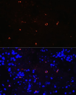 Invitrogen Lysozyme Recombinant Rabbit Monoclonal Antibody (9B2O6) 100