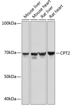 Invitrogen CPT2 Recombinant Rabbit Monoclonal Antibody (9V6M9) 100 &mu;L;